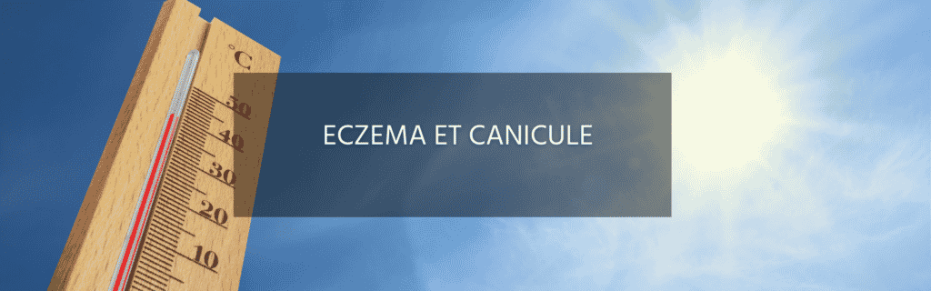 7 conseils pour résister à la canicule si vous souffrez d’eczéma