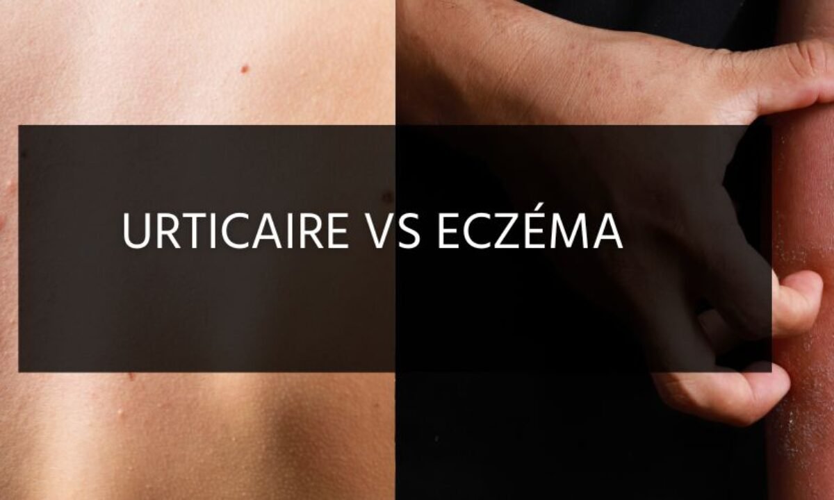 cigarette électronique justfog q16 Allergie à la cigarette électronique : que faire ? 🚬🤧